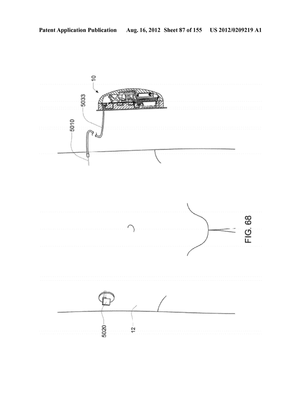 Adhesive and Peripheral Systems and Methods for Medical Devices - diagram, schematic, and image 88