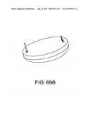 Adhesive and Peripheral Systems and Methods for Medical Devices diagram and image