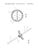 Multi-Lumen Catheter Including an Elliptical Profile diagram and image