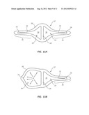 Multi-Lumen Catheter Including an Elliptical Profile diagram and image