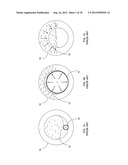 NANOTUBE-REINFORCED BALLOONS FOR DELIVERING THERAPEUTIC AGENTS WITHIN OR     BEYOND THE WALL OF BLOOD VESSELS, AND METHODS OF MAKING AND USING SAME diagram and image