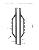 NANOTUBE-REINFORCED BALLOONS FOR DELIVERING THERAPEUTIC AGENTS WITHIN OR     BEYOND THE WALL OF BLOOD VESSELS, AND METHODS OF MAKING AND USING SAME diagram and image