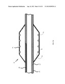 NANOTUBE-REINFORCED BALLOONS FOR DELIVERING THERAPEUTIC AGENTS WITHIN OR     BEYOND THE WALL OF BLOOD VESSELS, AND METHODS OF MAKING AND USING SAME diagram and image