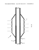 NANOTUBE-REINFORCED BALLOONS FOR DELIVERING THERAPEUTIC AGENTS WITHIN OR     BEYOND THE WALL OF BLOOD VESSELS, AND METHODS OF MAKING AND USING SAME diagram and image