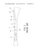 Support Instrument with Modular Intramedullary Nail diagram and image