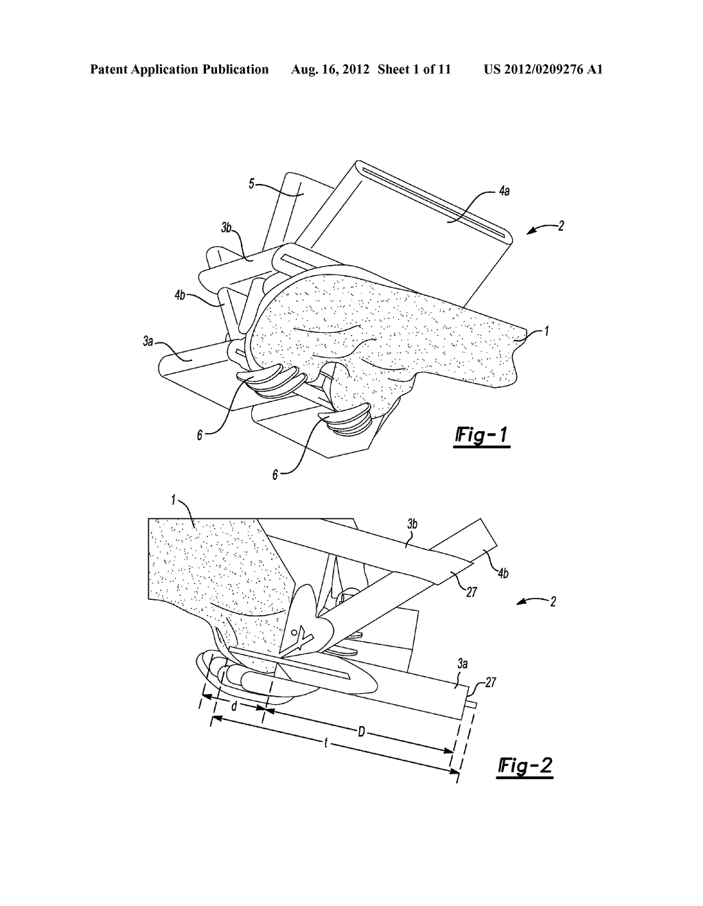 DEVICE FOR THE RESECTION OF BONES, METHOD FOR PRODUCING SUCH A DEVICE,     ENDOPROSTHESIS SUITED FOR THIS PURPOSE AND METHOD FOR PRODUCING SUCH AN     ENDOPROSTHESIS - diagram, schematic, and image 02