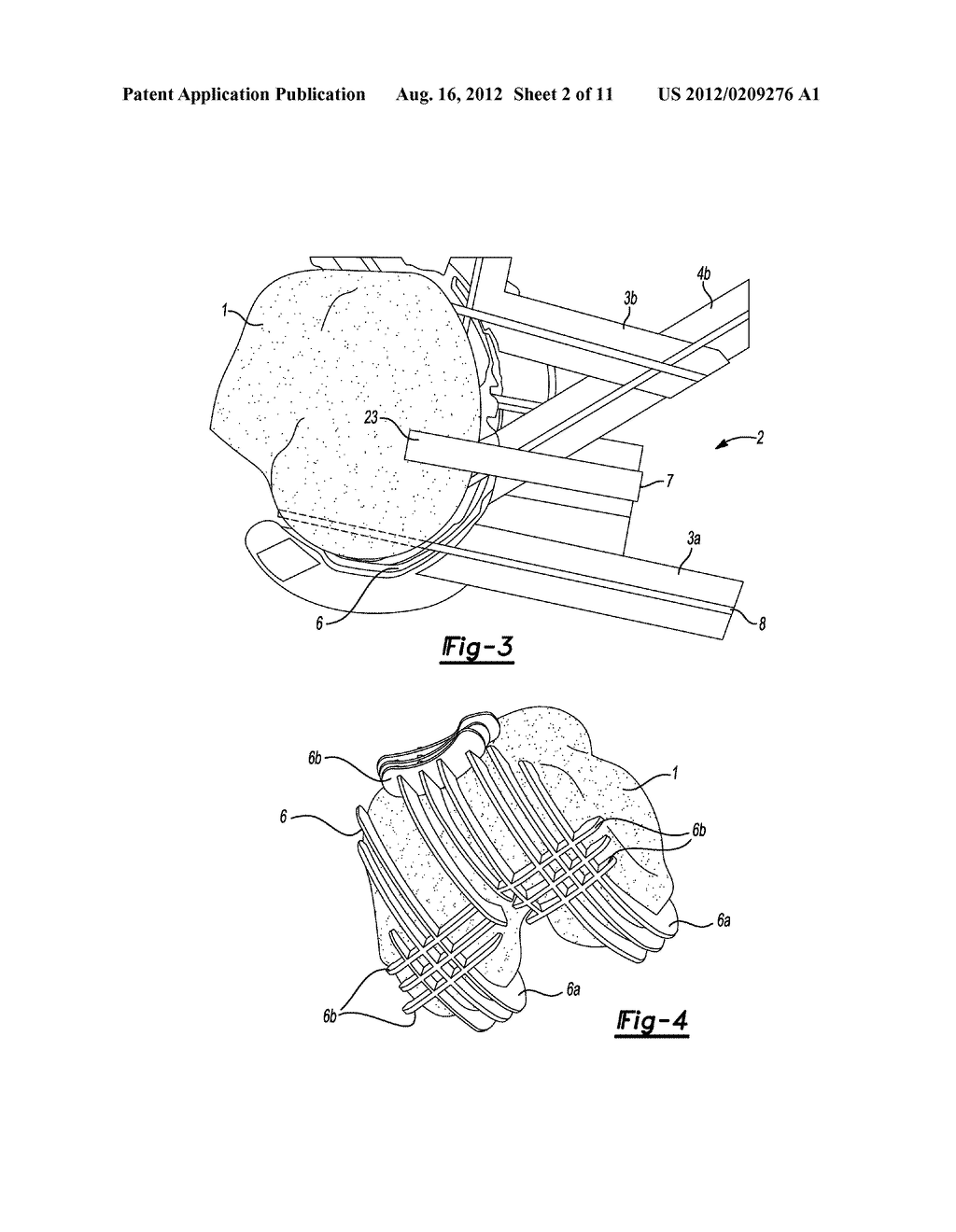 DEVICE FOR THE RESECTION OF BONES, METHOD FOR PRODUCING SUCH A DEVICE,     ENDOPROSTHESIS SUITED FOR THIS PURPOSE AND METHOD FOR PRODUCING SUCH AN     ENDOPROSTHESIS - diagram, schematic, and image 03
