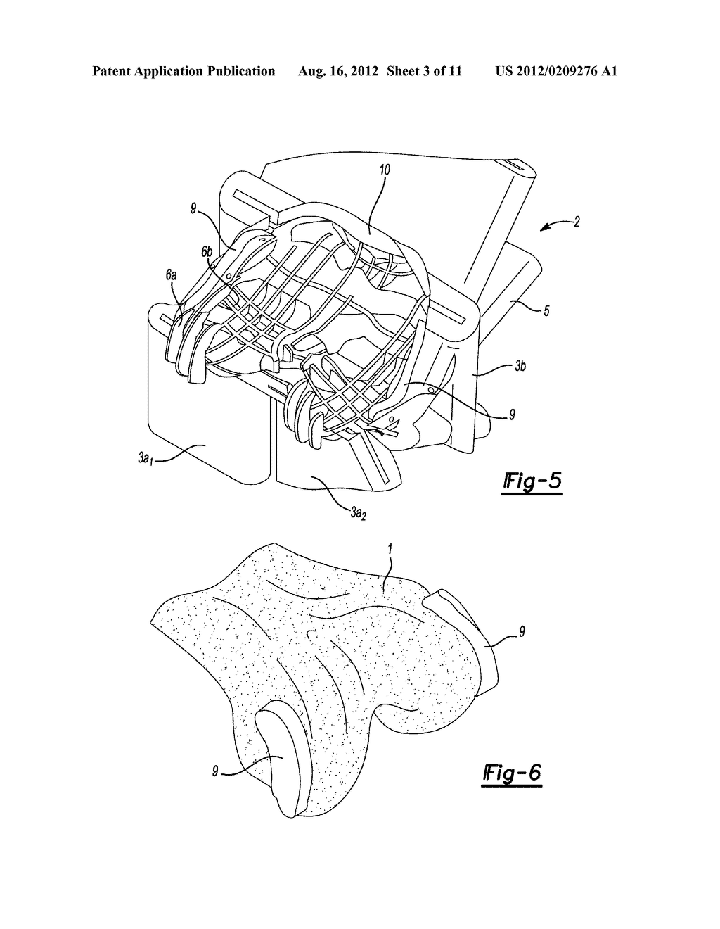 DEVICE FOR THE RESECTION OF BONES, METHOD FOR PRODUCING SUCH A DEVICE,     ENDOPROSTHESIS SUITED FOR THIS PURPOSE AND METHOD FOR PRODUCING SUCH AN     ENDOPROSTHESIS - diagram, schematic, and image 04