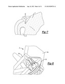 DEVICE FOR THE RESECTION OF BONES, METHOD FOR PRODUCING SUCH A DEVICE,     ENDOPROSTHESIS SUITED FOR THIS PURPOSE AND METHOD FOR PRODUCING SUCH AN     ENDOPROSTHESIS diagram and image