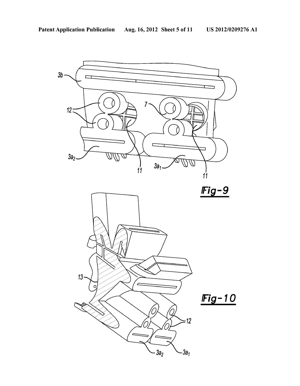 DEVICE FOR THE RESECTION OF BONES, METHOD FOR PRODUCING SUCH A DEVICE,     ENDOPROSTHESIS SUITED FOR THIS PURPOSE AND METHOD FOR PRODUCING SUCH AN     ENDOPROSTHESIS - diagram, schematic, and image 06
