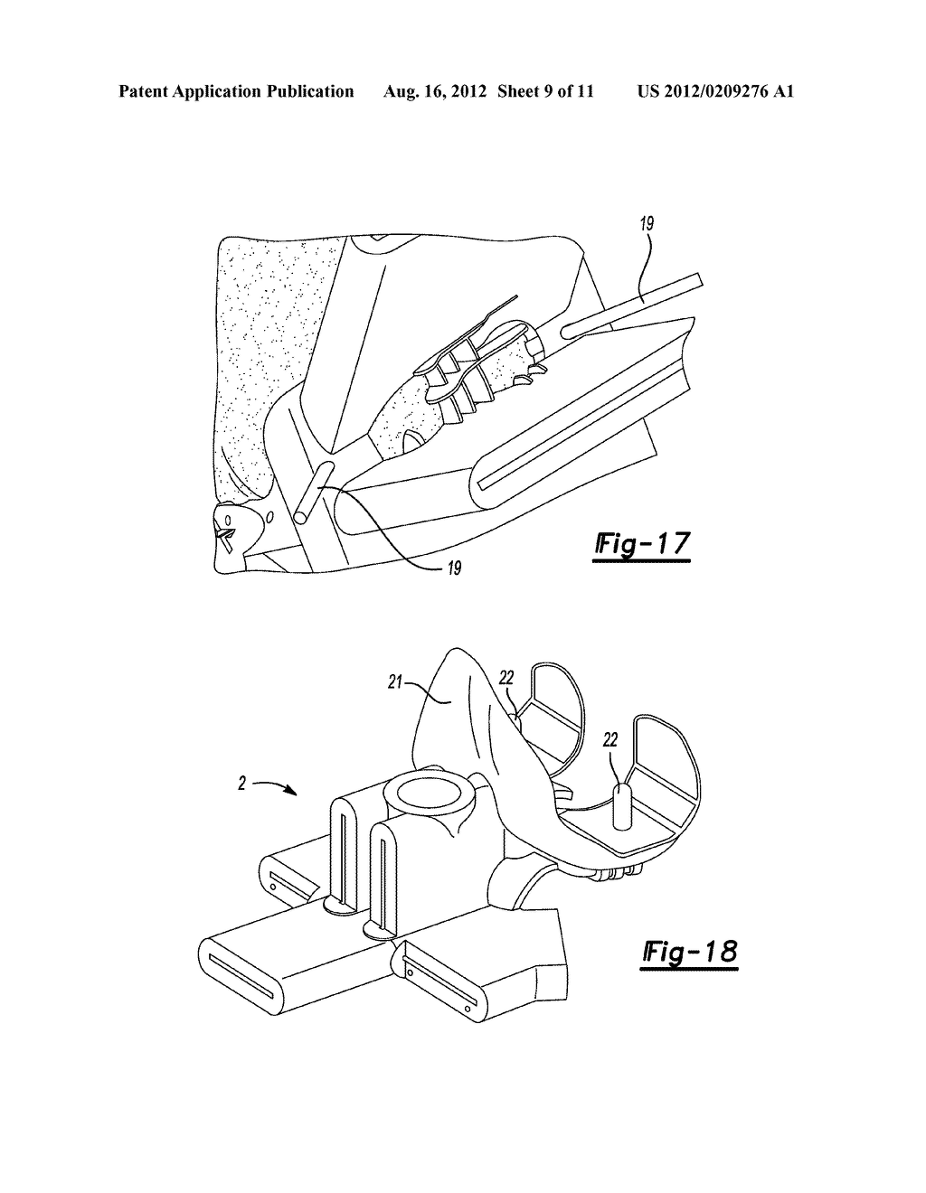 DEVICE FOR THE RESECTION OF BONES, METHOD FOR PRODUCING SUCH A DEVICE,     ENDOPROSTHESIS SUITED FOR THIS PURPOSE AND METHOD FOR PRODUCING SUCH AN     ENDOPROSTHESIS - diagram, schematic, and image 10