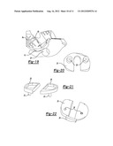 DEVICE FOR THE RESECTION OF BONES, METHOD FOR PRODUCING SUCH A DEVICE,     ENDOPROSTHESIS SUITED FOR THIS PURPOSE AND METHOD FOR PRODUCING SUCH AN     ENDOPROSTHESIS diagram and image