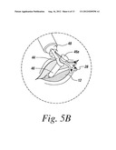 RIGIDLY GUIDED IMPLANT PLACEMENT diagram and image