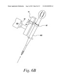 RIGIDLY GUIDED IMPLANT PLACEMENT diagram and image