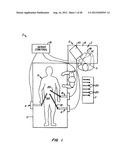 Surgical Accessory Clamp and System diagram and image