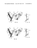 Telescoping Insertion Axis of a Robotic Surgical System diagram and image