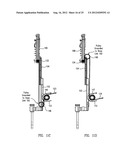 Telescoping Insertion Axis of a Robotic Surgical System diagram and image