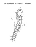 SUTURE SYSTEM AND ASSEMBLY INCLUDING A SUTURE CLIP diagram and image