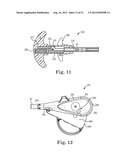 SUTURE SYSTEM AND ASSEMBLY INCLUDING A SUTURE CLIP diagram and image