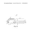 SUTURE SYSTEM AND ASSEMBLY INCLUDING A SUTURE CLIP diagram and image