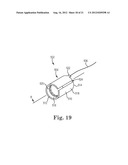 SUTURE SYSTEM AND ASSEMBLY INCLUDING A SUTURE CLIP diagram and image