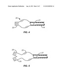 DELIVERY AND EXCHANGE CATHETER FOR STORING GUIDEWIRE diagram and image