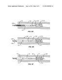 DELIVERY AND EXCHANGE CATHETER FOR STORING GUIDEWIRE diagram and image