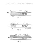 DELIVERY AND EXCHANGE CATHETER FOR STORING GUIDEWIRE diagram and image