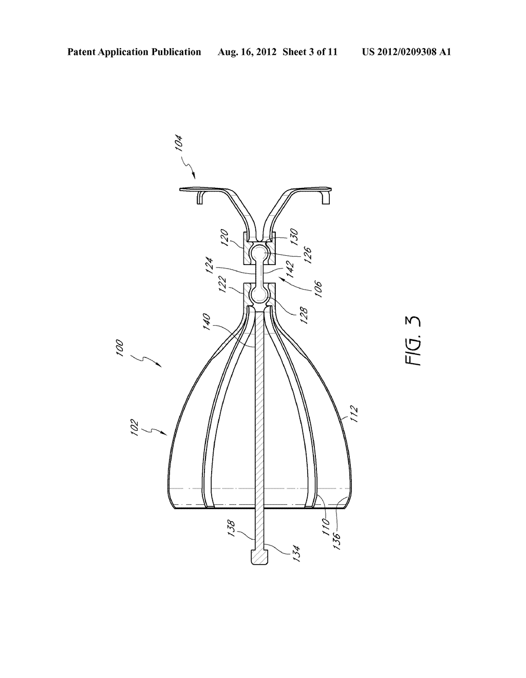 ARTICULABLE ANCHOR - diagram, schematic, and image 04