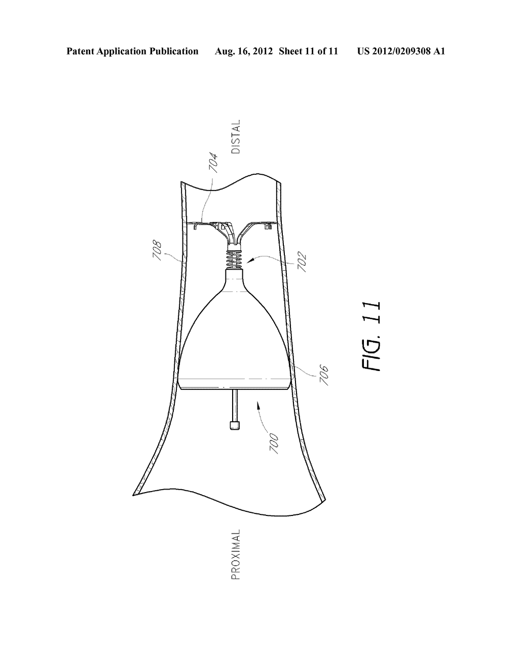 ARTICULABLE ANCHOR - diagram, schematic, and image 12