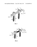 Spinal Stabilization Device diagram and image