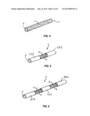 Spinal Stabilization Device diagram and image