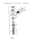 Spinal Stabilization Device diagram and image