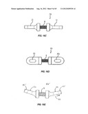 Spinal Stabilization Device diagram and image