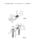 Spinal Stabilization Device diagram and image