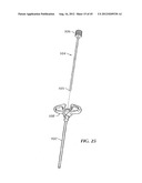 Spinal Stabilization Device diagram and image