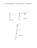 Spinal Stabilization Device diagram and image