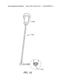 Spinal Stabilization Device diagram and image