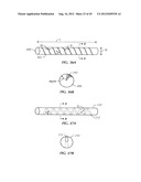 Spinal Stabilization Device diagram and image