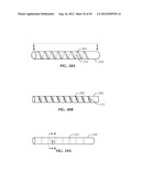 Spinal Stabilization Device diagram and image