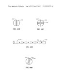 Spinal Stabilization Device diagram and image