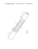 Spinal Stabilization Device diagram and image