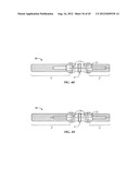 Spinal Stabilization Device diagram and image