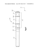 Spinal Stabilization Device diagram and image