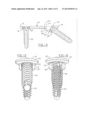 ORTHOPEDIC COMPRESSION PLATE diagram and image