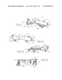 ORTHOPEDIC COMPRESSION PLATE diagram and image