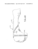 ORTHOPEDIC COMPRESSION PLATE diagram and image