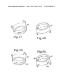 Polyaxial bone anchor with pop-on shank, friction fit retainer and winged     insert diagram and image