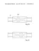 METHOD FOR THE TREATMENT OF GALLSTONES diagram and image