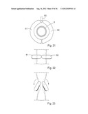 METHOD FOR THE TREATMENT OF GALLSTONES diagram and image